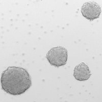 Neurospheres grown from adult olfactory bulb stem cells