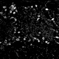 Calretinin inmunofluorescence, labeling olfactory bulb periglomerular interneurons