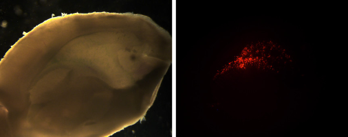 Electroporated postnatal mice lateral ventricular wall dissection