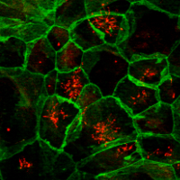 Ependymal cells differentiated from postnatal neural stem cells