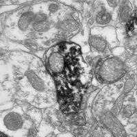 Dopaminergic olfactory bulb periglomerular interneuron contacting a mitral cell (TEM)